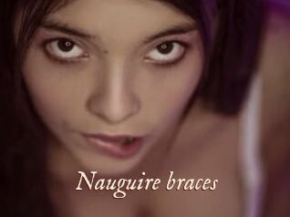 Nauguire_braces