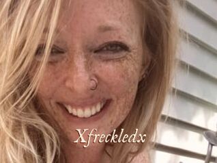 Xfreckledx